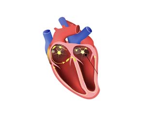 Cardiology disease