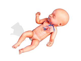 Cardiology disease