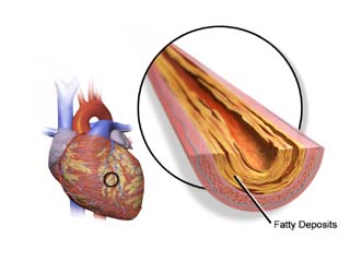 Cardiology disease