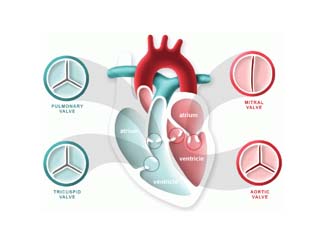 Cardiology disease