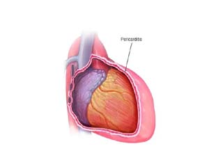 Cardiology disease