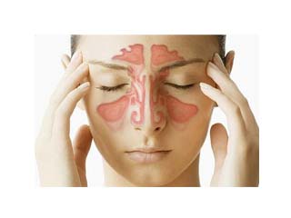 Sinus Problems