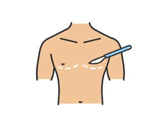 General Surgery